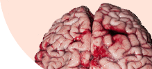 brain.png